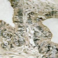 兔抗GAB2(Phospho-Ser623) 多克隆抗体