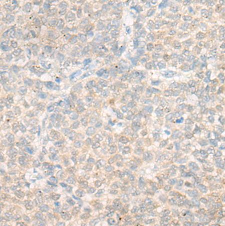 兔抗DHRS4多克隆抗体