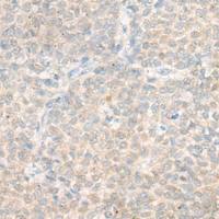 兔抗DHRS4多克隆抗体