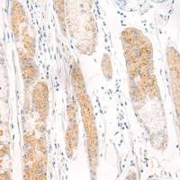 兔抗WNT5B多克隆抗体