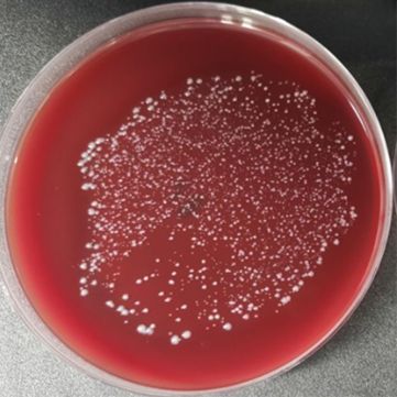 谷氨酸棒杆菌Ⅰ型
