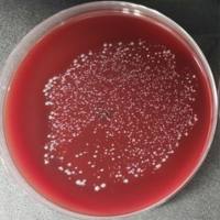 乳酸克鲁维酵母