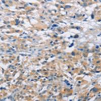 兔抗MTMR4多克隆抗体