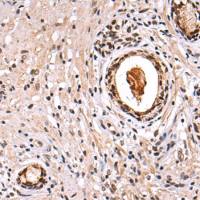 兔抗HEATR1多克隆抗体