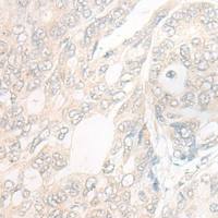 兔抗DNAJC9多克隆抗体