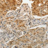 兔抗OGA多克隆抗体