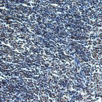 兔抗SLC2A12多克隆抗体