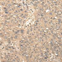 兔抗CCNYL1多克隆抗体