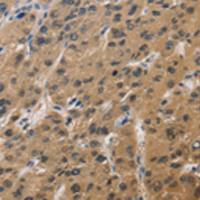 兔抗DUSP26多克隆抗体