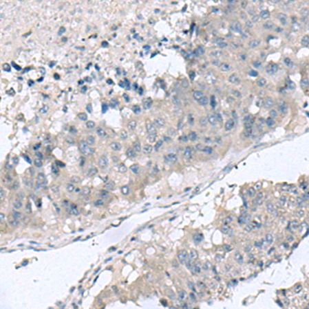 兔抗TNF多克隆抗体