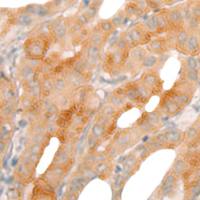 兔抗BBOX1多克隆抗体