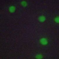 兔抗NKX6-3多克隆抗体 ​