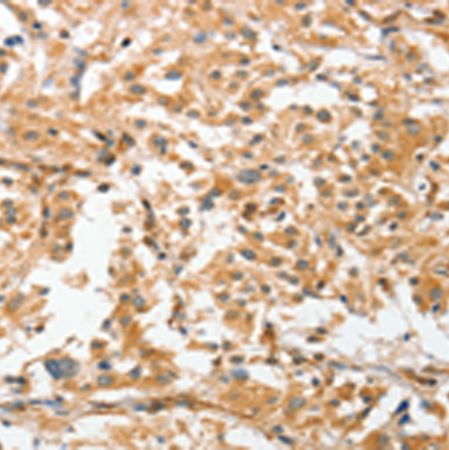 兔抗ANGPTL7多克隆抗体