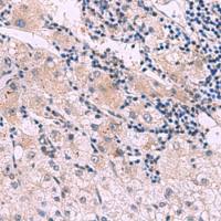 兔抗NMRK2多克隆抗体