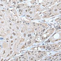 兔抗ZNF277多克隆抗体