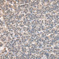 兔抗BTAF1多克隆抗体