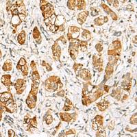 兔抗RIMS3多克隆抗体