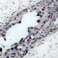 兔抗PTEN (Phospho-Ser380 Thr382 Thr383)多克隆抗体