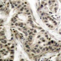 兔抗NFKB1 (Phospho-Ser337)多克隆抗体