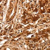 兔抗TGFBR1多克隆抗体