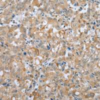 兔抗PLA2G4D多克隆抗体