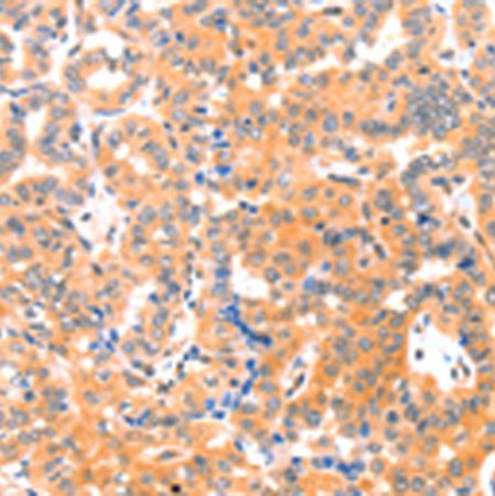 兔抗THBS1多克隆抗体