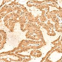 兔抗TIPRL多克隆抗体