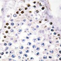 兔抗HOXA1/B1/D1多克隆抗体