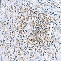 兔抗DHRS7B多克隆抗体