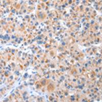 兔抗CXCR4多克隆抗体