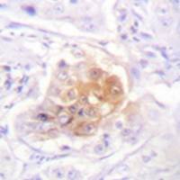 兔抗IL2RB(Ab-364) 多克隆抗体