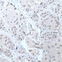 兔抗PPP1R42多克隆抗体