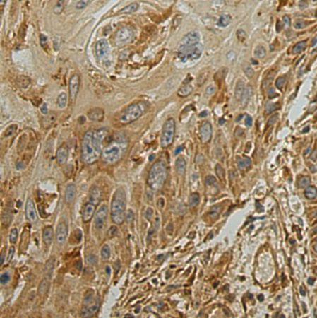 兔抗ALPL多克隆抗体