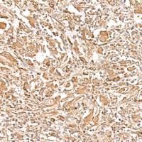 兔抗PLBD1多克隆抗体