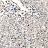 兔抗SLC35E2A多克隆抗体