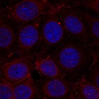 兔抗IGF1R (Phospho-Tyr1165/Tyr1166)多克隆抗体