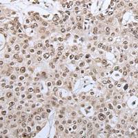 兔抗SLITRK5多克隆抗体