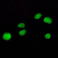 兔抗COL23A1多克隆抗体