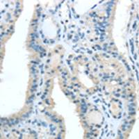 兔抗TRIB1多克隆抗体