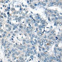 兔抗CEP89多克隆抗体