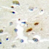 兔抗REV3L多克隆抗体