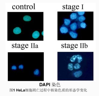 细胞凋亡检测选购宝典