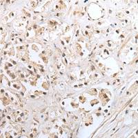 兔抗SNF8多克隆抗体