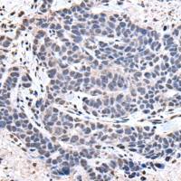 兔抗NKX2-5多克隆抗体