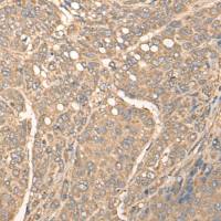 兔抗BBS1多克隆抗体