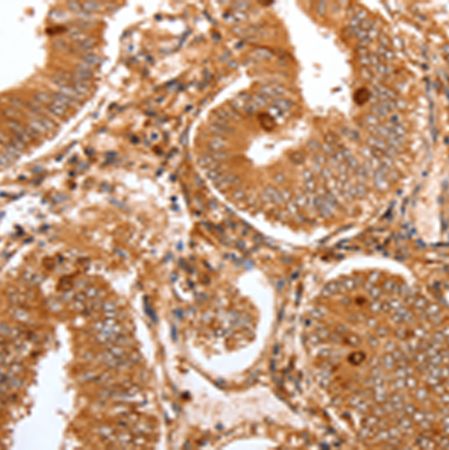 兔抗FOXO3多克隆抗体