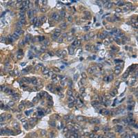 兔抗TRAPPC4多克隆抗体