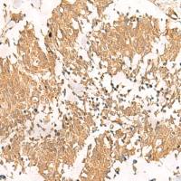 兔抗MTHFD2L多克隆抗体