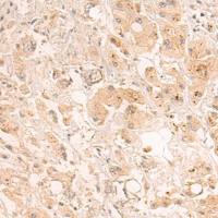 兔抗ZDHHC5多克隆抗体