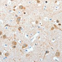 兔抗AKAP4多克隆抗体